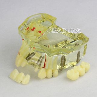 dental in Dental