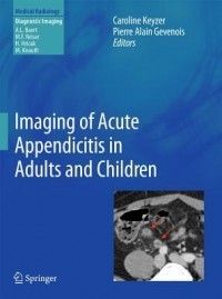 Imaging of Acute Appendicitis in Adults and Children NE 3642178715 