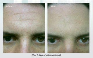 NERIUM SKIN CARE AGE DEFYING TREATMENT REAL RESULTS IN JUST DAYS